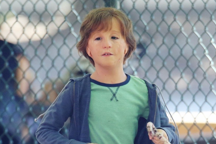 ‘Extraordinário’: entenda a síndrome retratada no filme