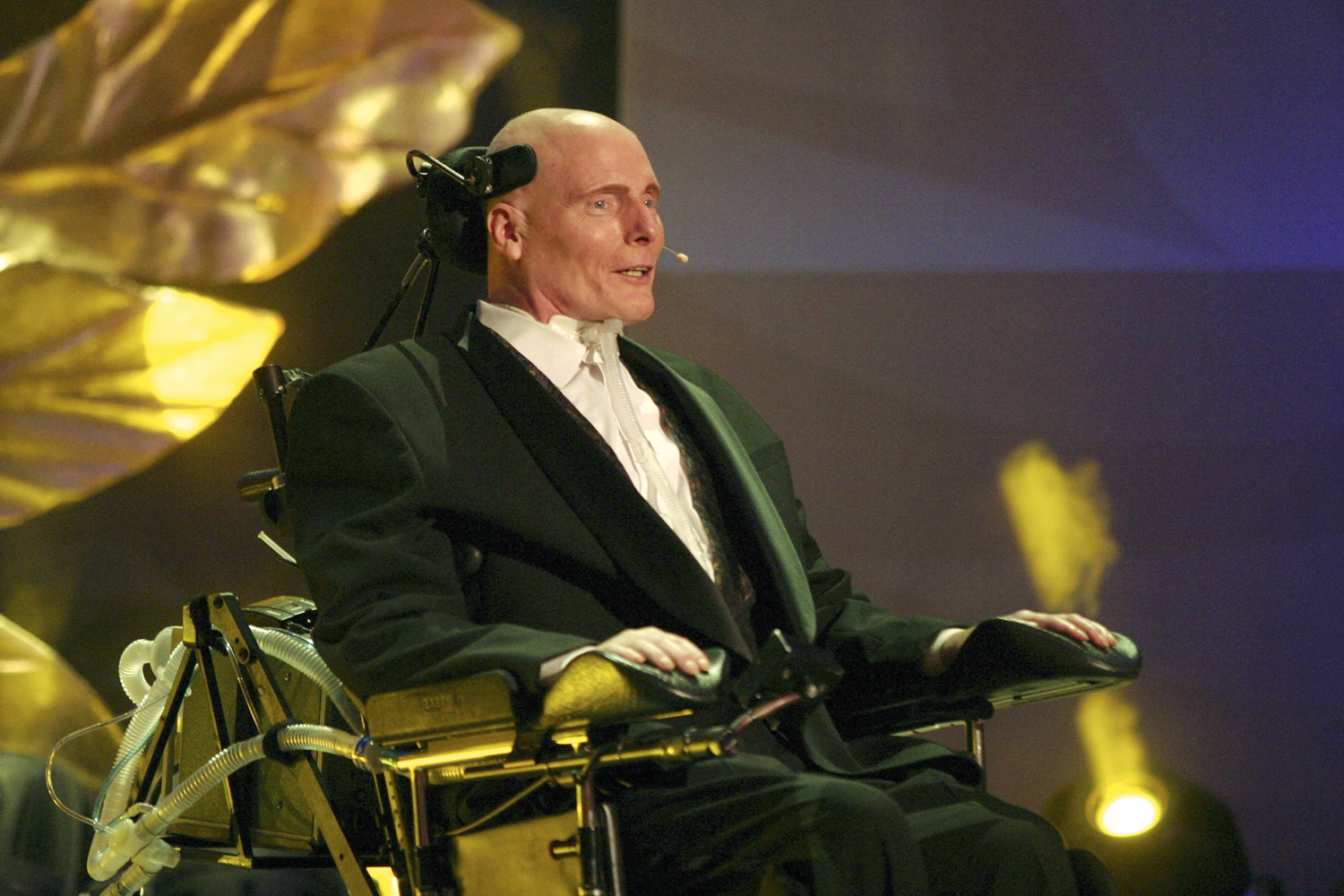 SUPERA&Ccedil;&Atilde;O -&ensp;Ap&oacute;s o acidente: volta ao set como diretor e luta por pesquisas